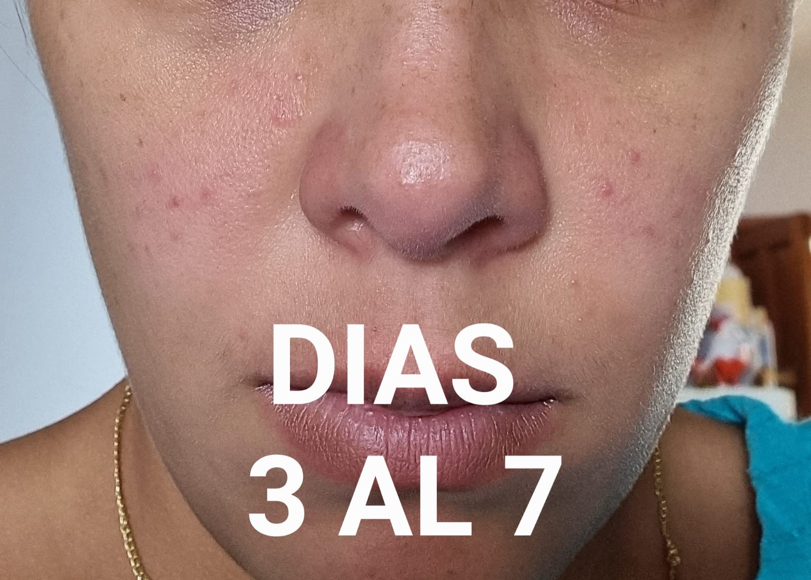 Alivia el picor