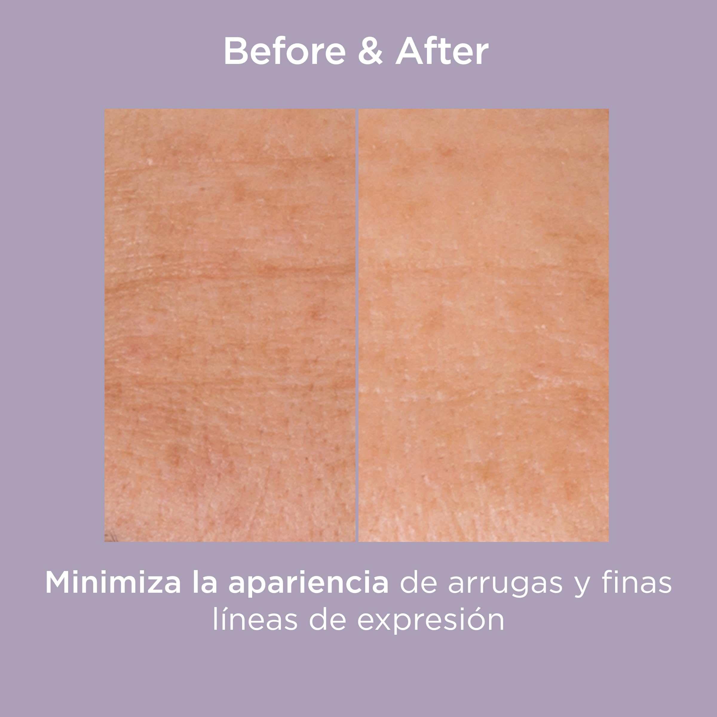 isdin-isdinceutics-glicoisdin-25-gel-exfoliante-cido-glic-lico-25-g image 3