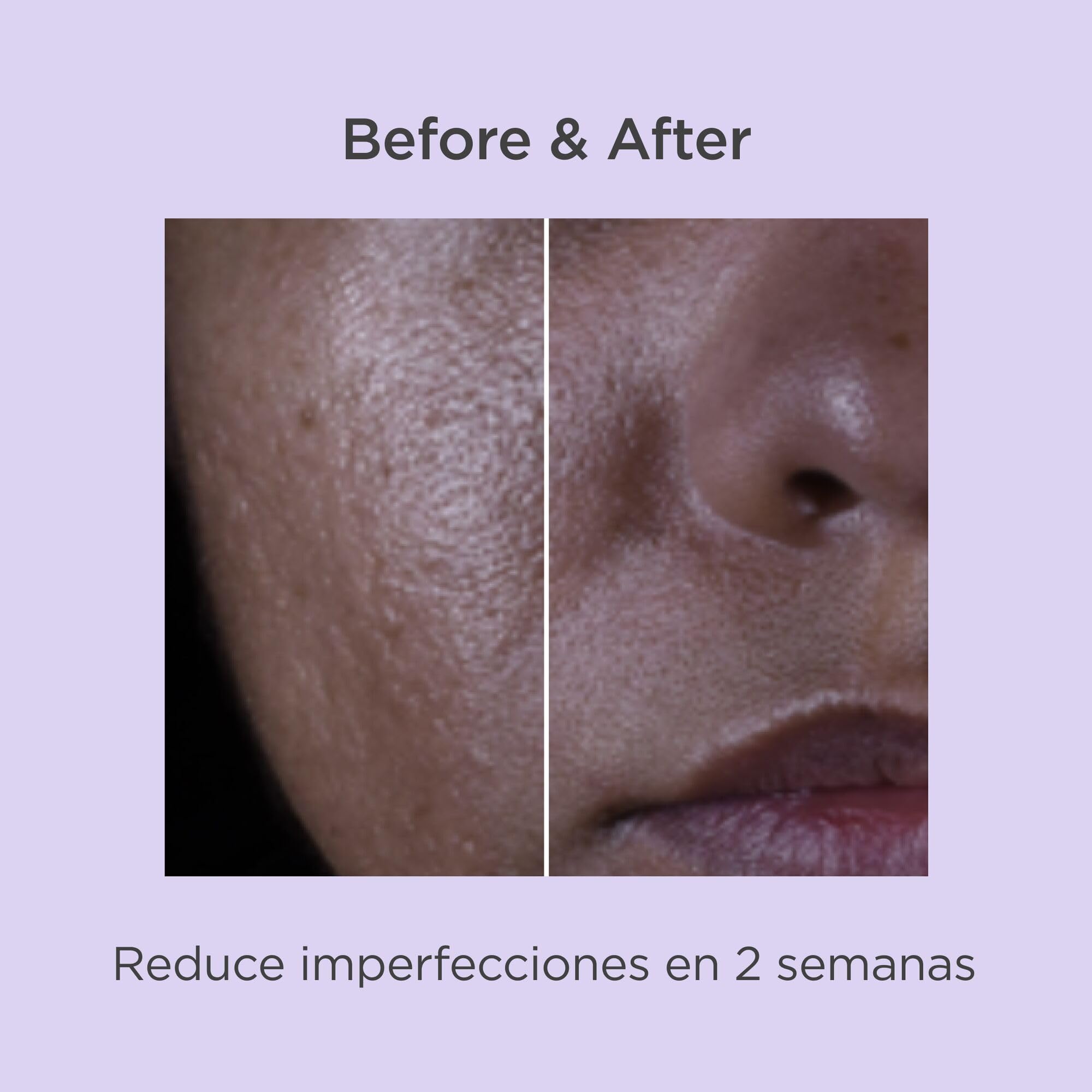 isdin-isdinceutics-salicylic-renewal-s-rum-antiimperfecciones-30-ml image 8