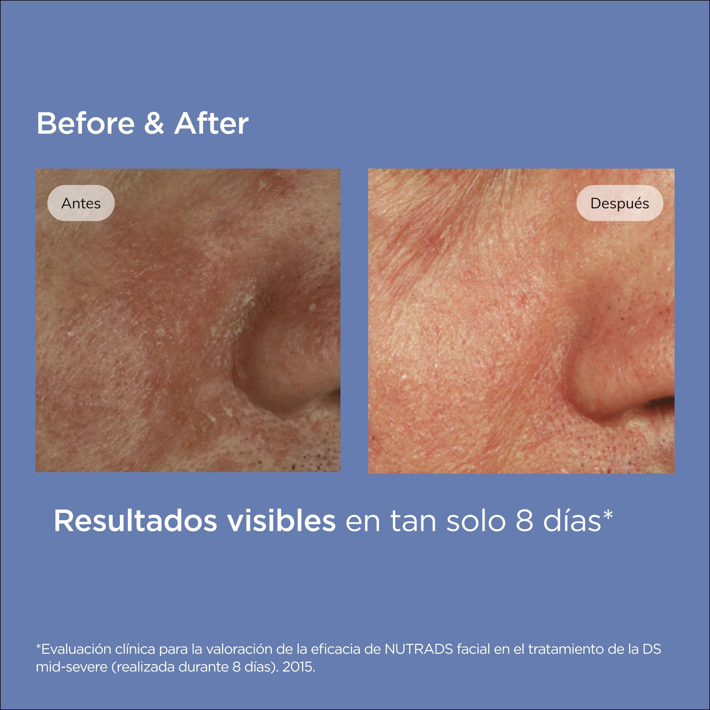 isdin-nutradeica-gel-crema-facial-piel-seborreica-50-ml image 8