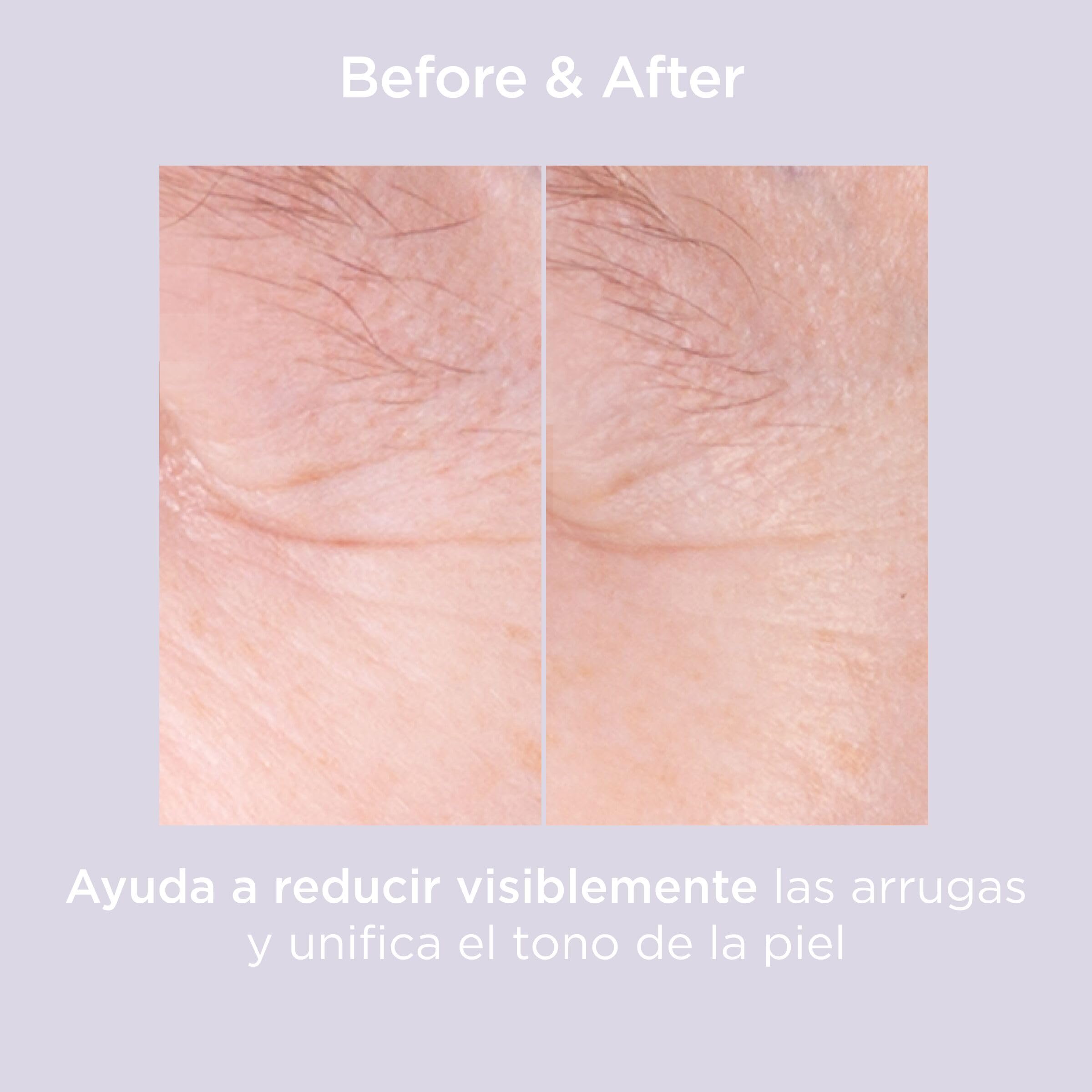 isdin-isdinceutics-glicoisdin-15-moderate-gel-facial-peeling-50-ml image 8