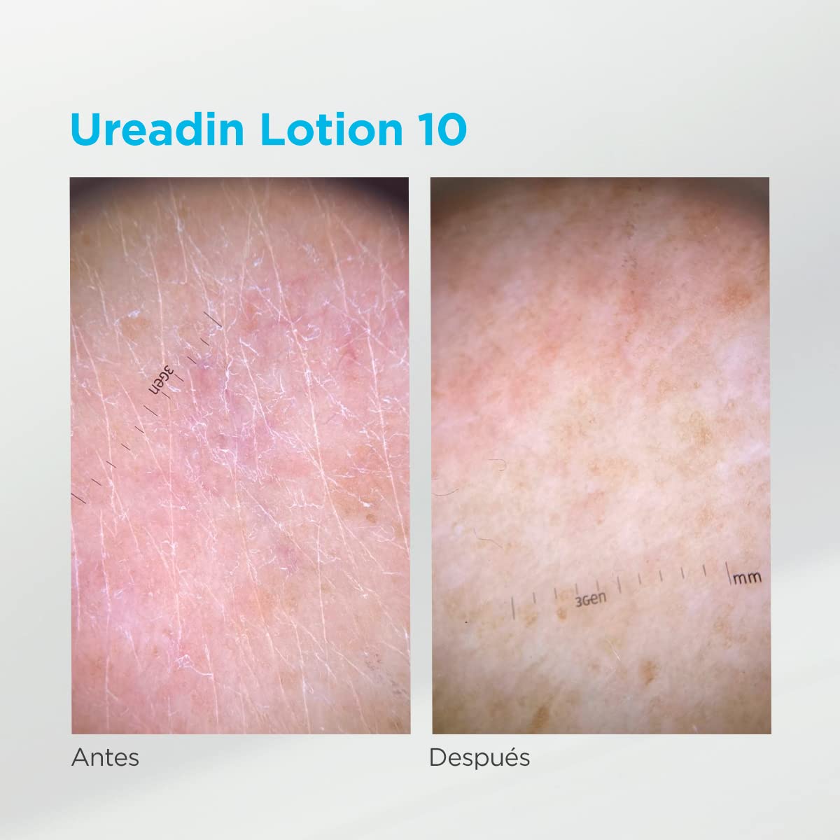 isdin-ureadin-lotion10-loci-n-corporal-pack-400-ml-200-ml image 7
