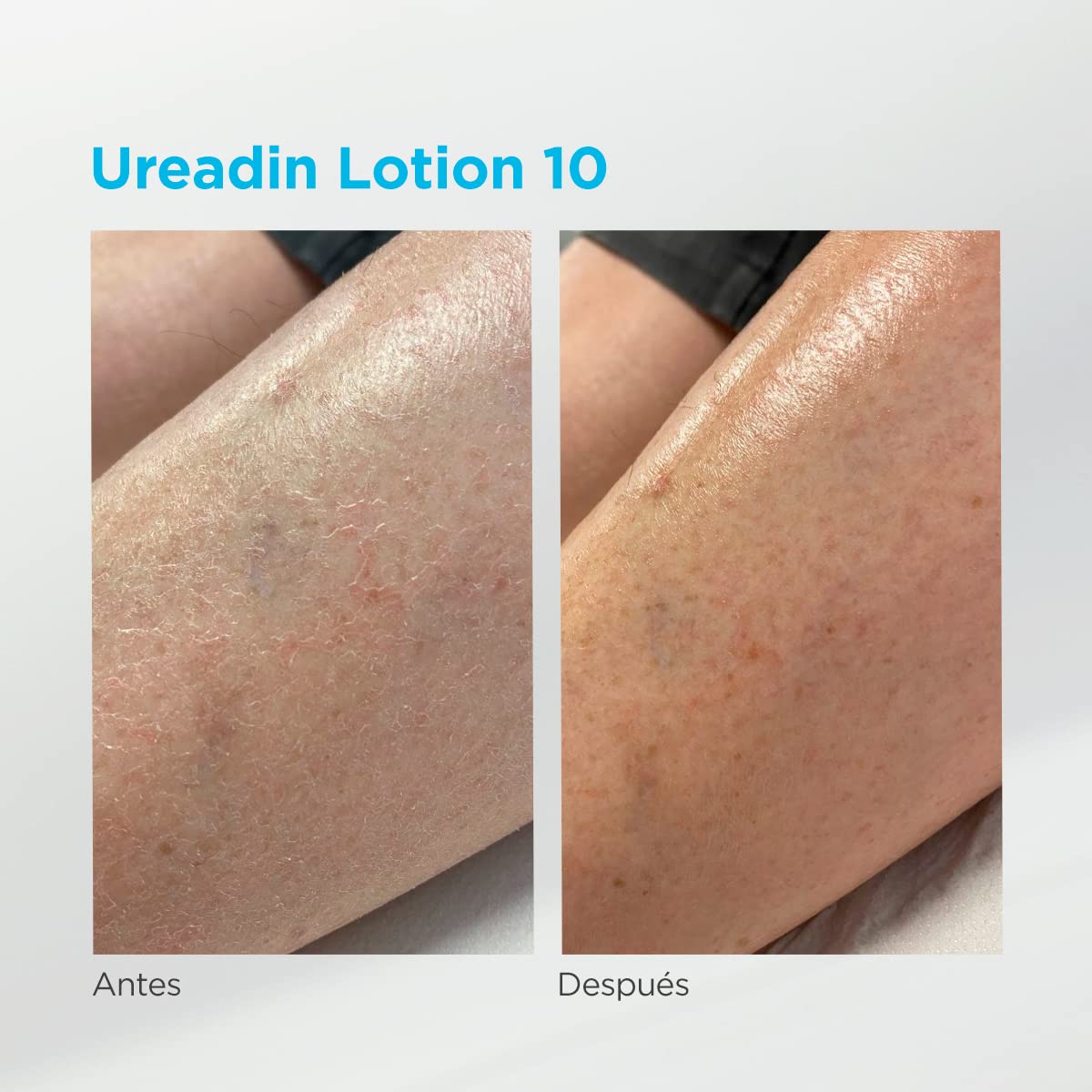 isdin-ureadin-lotion10-loci-n-corporal-pack-400-ml-200-ml image 6