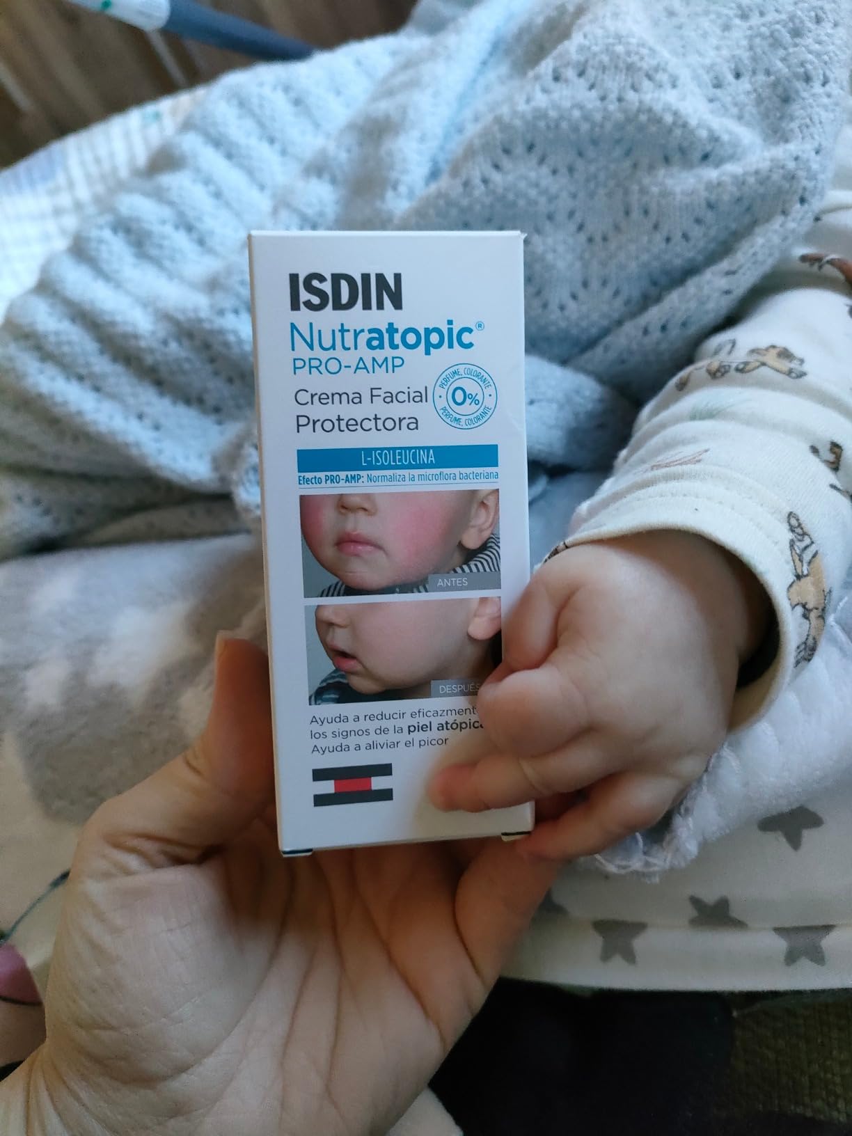 Alivio para la dermatitis