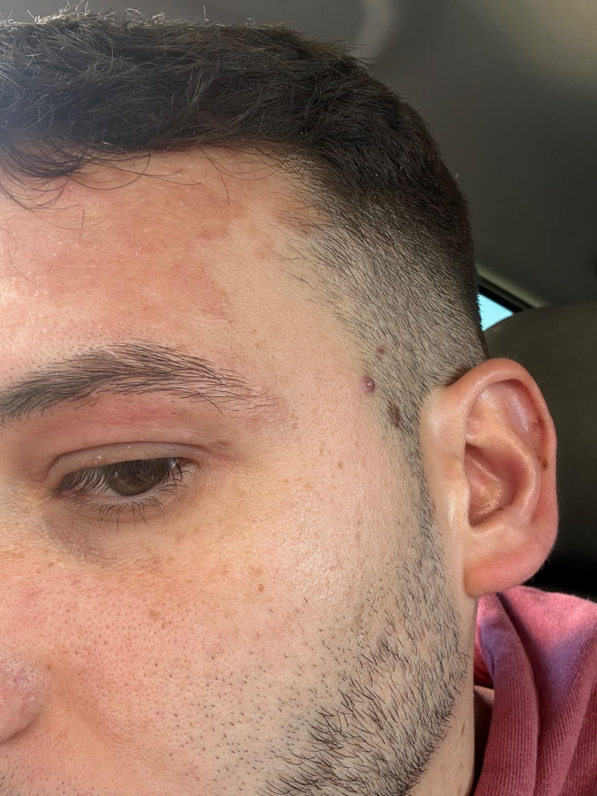 Mi dermatólogo me la recomendó