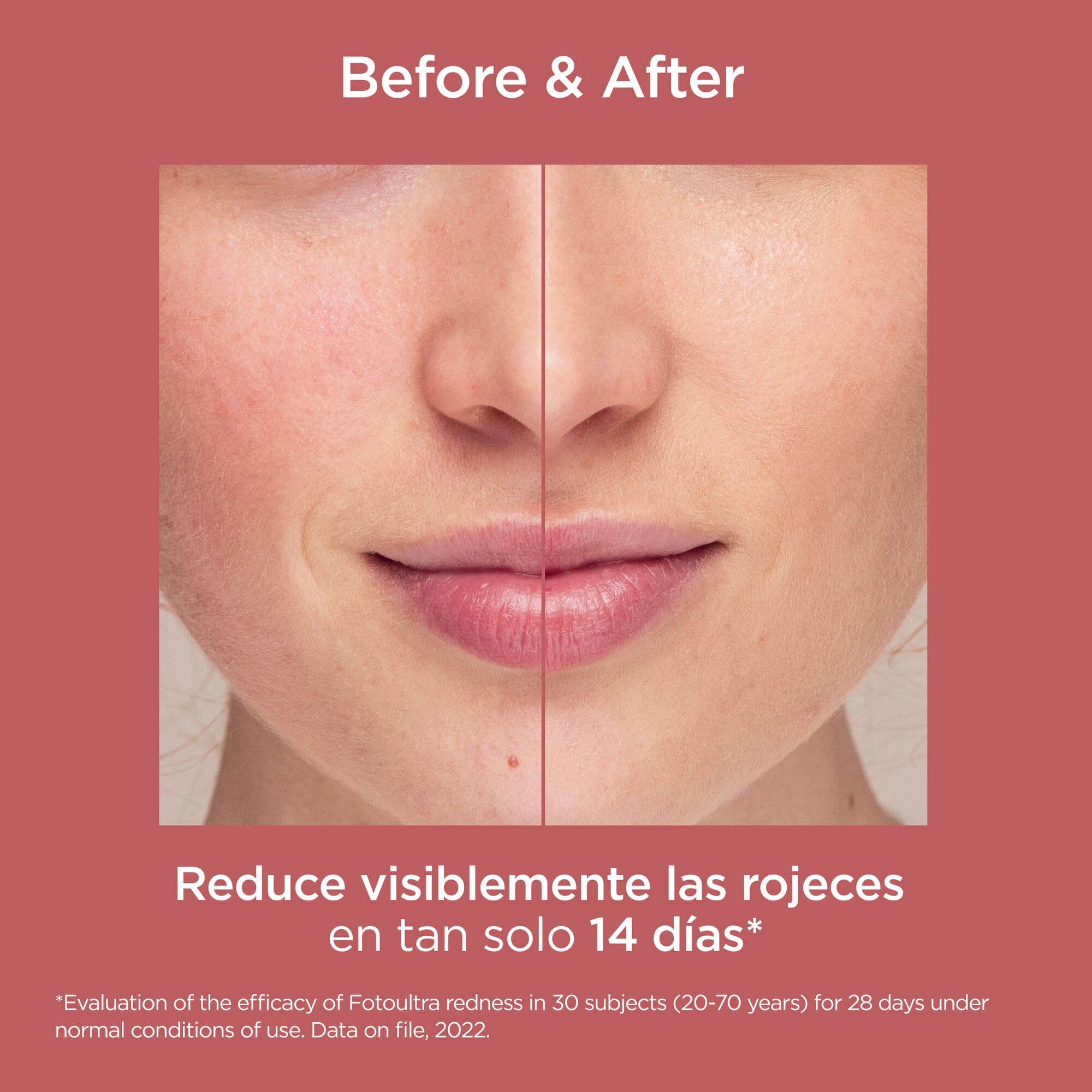 isdin-fotoultra-redness-spf-50-protector-solar-facial-piel-sensible-50-ml image 8