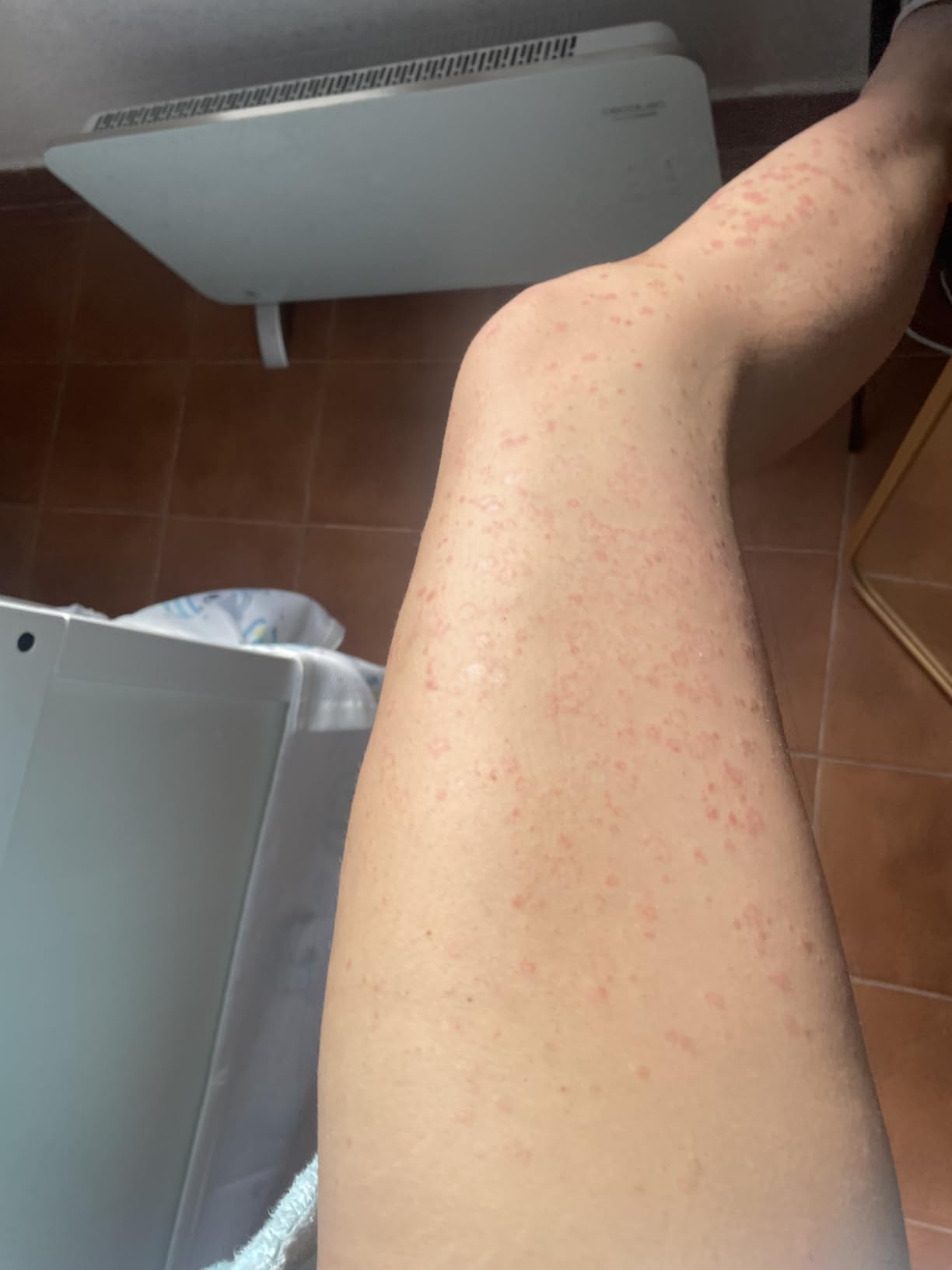 Buena para psoriasis leve